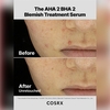 CosRX The AHA 2 BHA 2 Blemish Treatment Serum