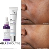 La Roche-Posay Mela B3 Serum