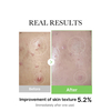 Medicube Exosome Cica Serum