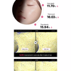 Mediheal Rose PDRN Essential Mask (Healthy Glow)