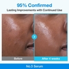 Numbuzin No.3 Blue Bio-Retinol Pore Refining Serum
