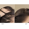 Rene Furterer Triphasic Reactional Hair Loss Treatment