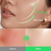 Shaishaishai ALOE PDRN Cooling Repair Ampoule